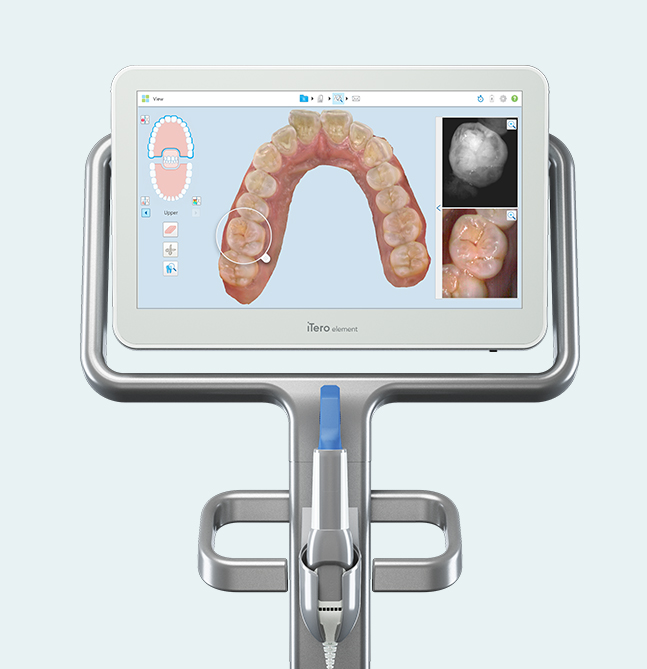 Digital orthodontic scanner displaying 3D dental arch model and intraoral images on screen.