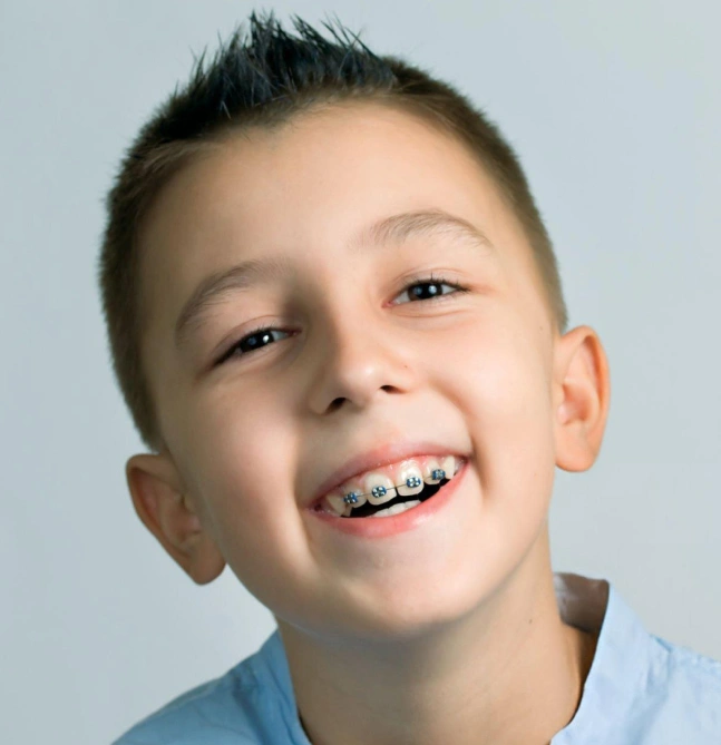 Young boy smiling brightly at camera, wearing blue shirt, orthodontic braces visible on teeth.
